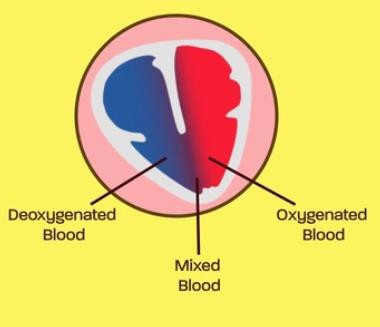 Three-chambered heart